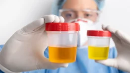 Combate las infecciones urinarias con infusión de llantén: esta es la manera correcta de consumirla