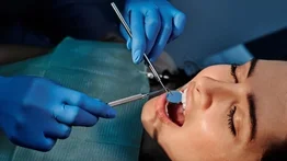 Odontología gratuita: conozca los tratamientos especializados que ofrece el Ivss