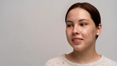 Aclara las manchas del rostro con perejil: esta es la manera correcta de utilizarlo