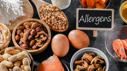 FDA alérgenos no declarados