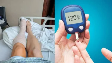 Mujer en Carolina del Sur perdió los dedos de sus pies por esta insólita razón