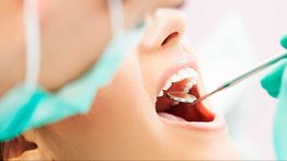 Así puede agendar su cita para el servicio de odontología gratuito en Baruta: ubicaciones y horario disponible