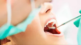 Así puede agendar su cita para el servicio de odontología gratuito en Baruta: ubicaciones y horario disponible