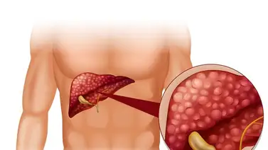 Desintoxicación natural: limpia el hígado con infusión de diente de león  Desintoxicación natural: limpia el hígado con infusión de diente de león