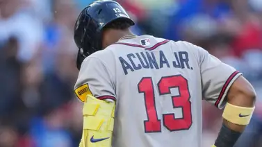 Ronald Acuña Jr. sufre lesión en el tendón de la corva: ¿Cuánto tiempo estará fuera? Ronald Acuña Jr. sufre lesión en el tendón de la corva: ¿Cuánto tiempo estará fuera?