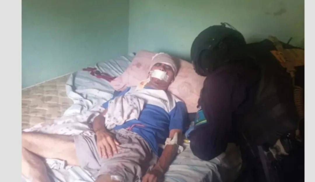 Lo golpearon en la cabeza con una piedra: sexagenario lucha por su vida tras violento asalto Lo golpearon en la cabeza con una piedra: sexagenario lucha por su vida tras violento asalto