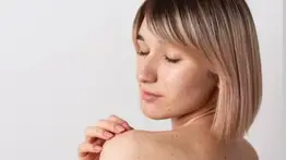 Puntos negros en la piel por el calor: este es el método más efectivo para acabarlos con solo tres ingredientes