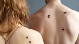 Alerta médica en dermatología: el incremento de tumores cutáneos y la importancia de la prevención