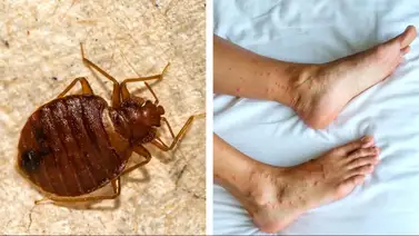 Dos hispanos ganan demanda civil por 2 millones de dólares: fueron atacados por chinches en un hotel del sur de California Dos hispanos ganan demanda civil por 2 millones de dólares: fueron atacados por chinches en un hotel del sur de California