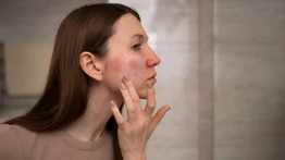Dile adiós a la piel reseca: así debes aplicar esta efectiva crema natural a base de tres ingredientes