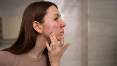Dile adiós a la piel reseca: así debes aplicar esta efectiva crema natural a base de tres ingredientes