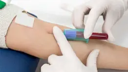 Universidad estadounidense logra detección temprana del cáncer: nueva prueba de sangre anticipa recaídas