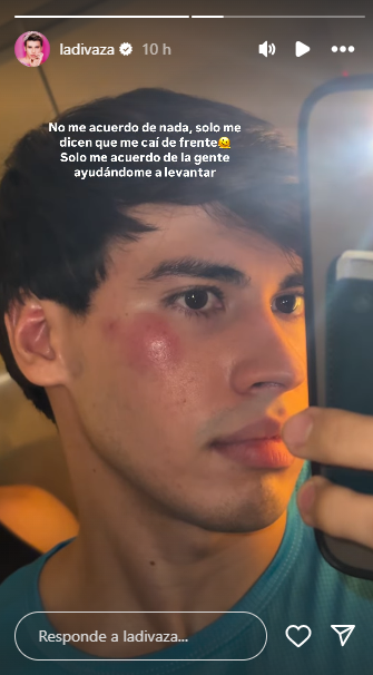 La Divaza muestra fuerte golpe en el rostro: "No me acuerdo de nada" La Divaza muestra fuerte golpe en el rostro: "No me acuerdo de nada"