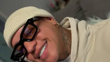 Gio Martinez estrena nuevo rostro: se hizo una cirugía y así quedó Gio Martinez estrena nuevo rostro: se hizo una cirugía y así quedó