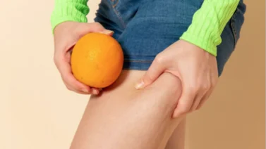 Resultados anticelulitis milagrosos: la revolución de la estética sin cirugías
