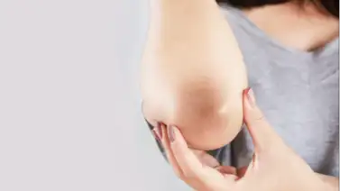 Olvídate de codos, rodillas y axilas negras: regla de los 3 minutos Olvídate de codos, rodillas y axilas negras: regla de los 3 minutos