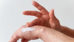 Evita la piel reseca: esta es la milagrosa mascarilla que la hidrata a profundidad