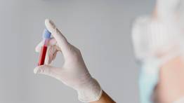 Jugo rico en hierro y vitaminas para subir la hemoglobina: así debes consumirlo para aprovechar todos sus beneficios