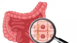 Potente licuado que combina dos frutas tropicales y limpia el colon al natural: fácil de preparar y a muy bajo costo