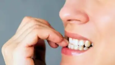 De la ansiedad al hábito: conozca que genera comerse las uñas De la ansiedad al hábito: conozca que genera comerse las uñas