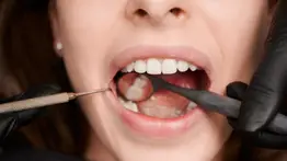 Fórmula natural a base de limón para blanquear los dientes: esta es la cantidad que debes aplicar para aprovechar el efecto