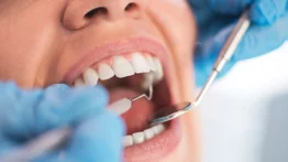 Estos son los servicios gratuitos de odontología que puede solicitar en el Ivss