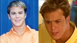 El calvario de Joel Borges tras retoque estético extremo: “Me inyectaron más de 40 veces la cara”