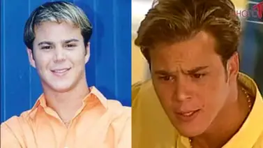 El calvario de Joel Borges tras retoque estético extremo: “Me inyectaron más de 40 veces la cara” El calvario de Joel Borges tras retoque estético extremo: “Me inyectaron más de 40 veces la cara”