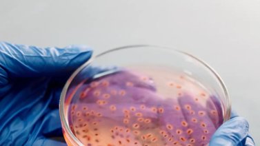 ¡Pandemia silenciosa! Confiman existencia de un gen inmune a los antibióticos: así funciona en el organismo