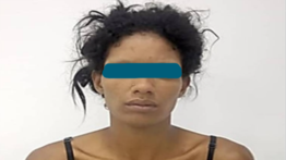 Por celos le propinó brutal golpiza a otra mujer: le fracturó las costillas 