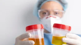 Dile adiós a la infección urinaria con esta infusión natural: esta es la mejor hora para consumirla