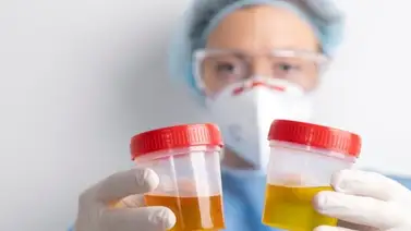 Dile adiós a la infección urinaria con esta infusión natural: esta es la mejor hora para consumirla Dile adiós a la infección urinaria con esta infusión natural: esta es la mejor hora para consumirla