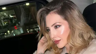 Sacha Fitness revela todo su tratamiento facial: incluye botox y luz pulsada  Sacha Fitness revela todo su tratamiento facial: incluye botox y luz pulsada