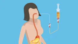 ¡Cuidado con modas peligrosas! Alertan sobre los riesgos de la “dieta de la mochila”: método controversial prende las alarmas