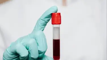 Deja atrás la anemia con esta fruta rica en hierro: entérate cuál es la cantidad que debes comer al día para aprovechar sus propiedades Deja atrás la anemia con esta fruta rica en hierro: entérate cuál es la cantidad que debes comer al día para aprovechar sus propiedades
