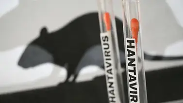 Qué es el Hantavirus y sus síntomas: confirman tres muertes en Venezuela por esta enfermedad Qué es el Hantavirus y sus síntomas: confirman tres muertes en Venezuela por esta enfermedad