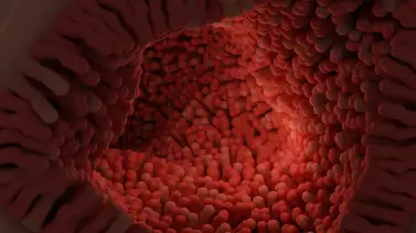 ¿Inflamación frecuente? La microbiota intestinal podría ser la causa ¿Inflamación frecuente? La microbiota intestinal podría ser la causa