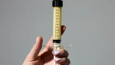 AlloClae: la controversial inyección estética que promete devolver el volumen corporal tras usar Ozempic AlloClae: la controversial inyección estética que promete devolver el volumen corporal tras usar Ozempic