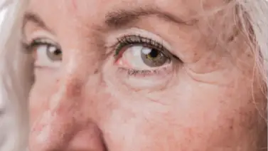 Suaviza las arrugas de tu rostro con este simple ingrediente: una opción natural y efectiva Suaviza las arrugas de tu rostro con este simple ingrediente: una opción natural y efectiva