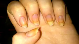 Desmancha las uñas fácilmente con estos ingredientes