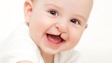 Activan jornada de atención de salud bucal pediátrica en Hospital doctor Domingo Luciani (+Detalles)