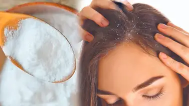 Bicarbonato en el cabello: pros y contras de su uso Bicarbonato en el cabello: pros y contras de su uso
