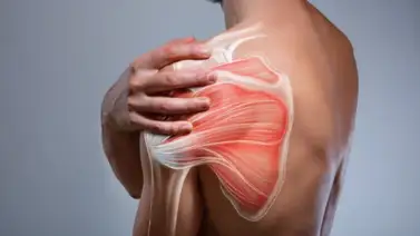 ¿Distensión en el manguito rotador? ¡Soluciónalo! ¿Distensión en el manguito rotador? ¡Soluciónalo!