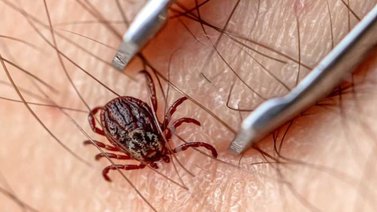 Investigan casos febriles que podrían vincularse a picaduras de garrapatas en Mérida
