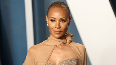 Alopecia femenina: guía para recuperar tu hermosa cabellera