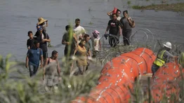 Venezolano atravesó la selva del Darién con una sola pierna para llegar a México