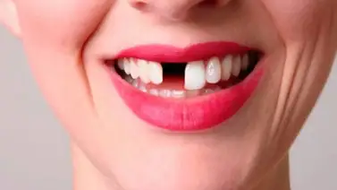 Empezarán con los ensayos del primer fármaco para hacer crecer los dientes (+Detalles) Empezarán con los ensayos del primer fármaco para hacer crecer los dientes (+Detalles)