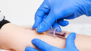 ¿Es realmente necesario ayunar para un análisis de sangre?