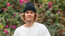 Fotos de Justin Bieber preocuparon a sus fanáticos (+Detalles)