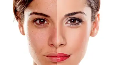 Con este tubérculo eliminarás las manchas en tu rostro Con este tubérculo eliminarás las manchas en tu rostro